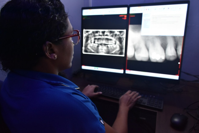 Observación de estudios panorámicos en pacientes con dolares maxilares. Foto: Cortesía